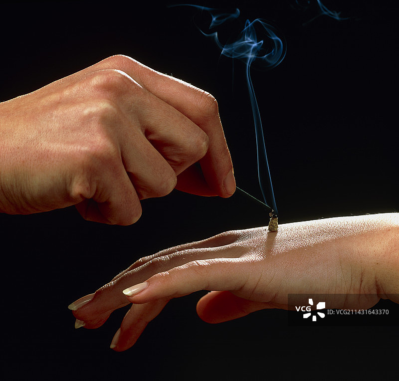 针灸师在手背上施用艾灸图片素材
