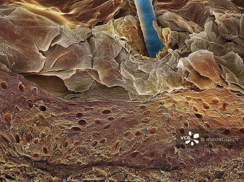 皮肤切面扫描电子显微镜图片素材