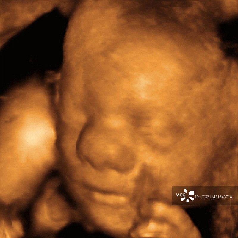 胎儿面部3D超声波扫描图片素材