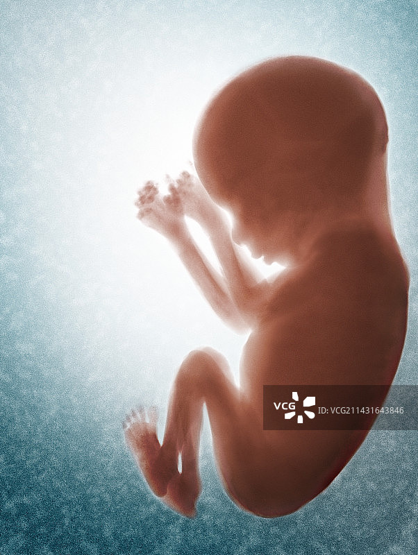 胎儿计算机艺术作品图片素材
