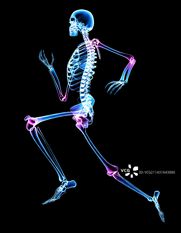 关节炎图片素材