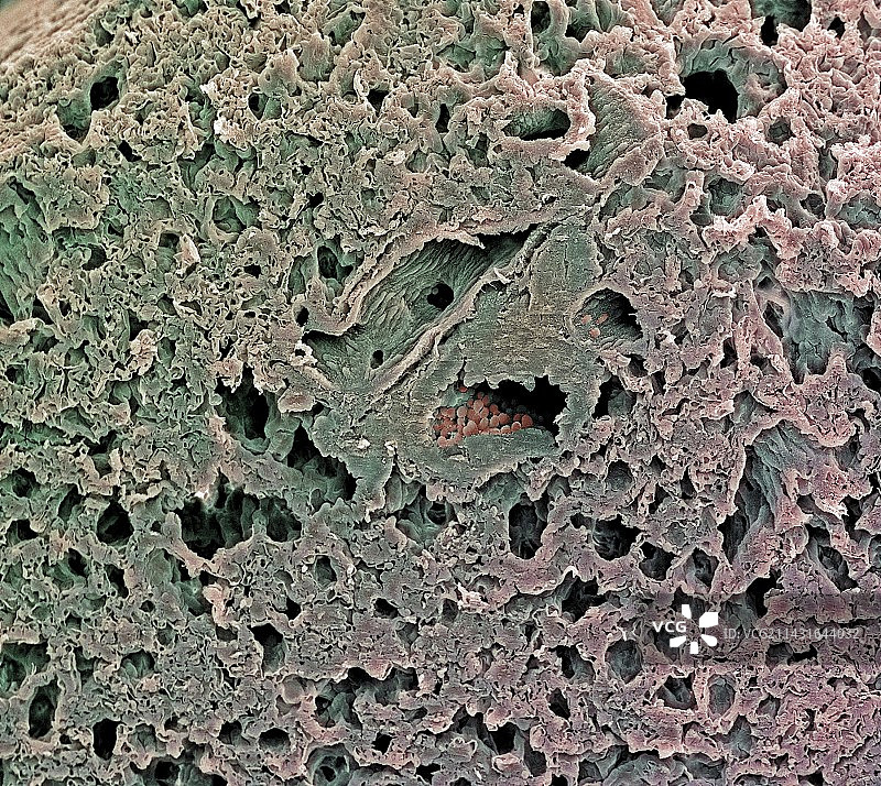 肺泡扫描电镜图图片素材