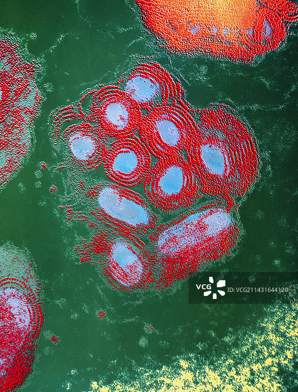 人体肥大细胞中颗粒的彩色透射电镜图图片素材