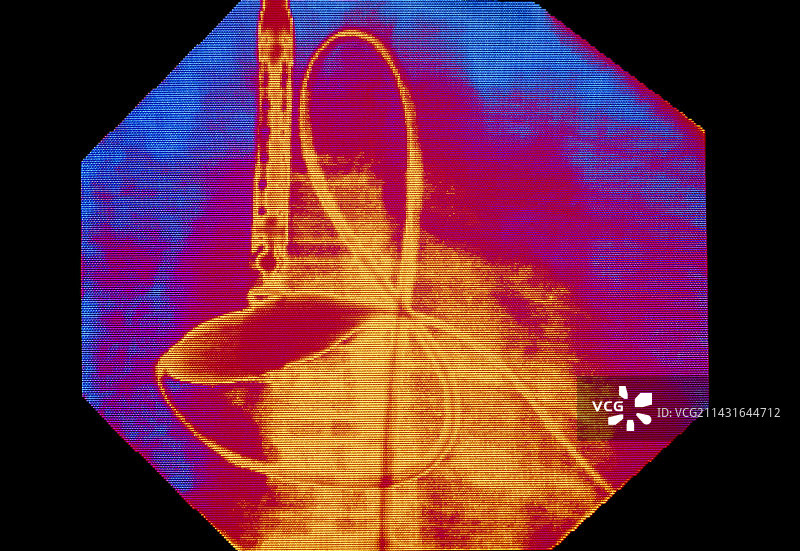 心脏血管成形术的彩色X光片图片素材