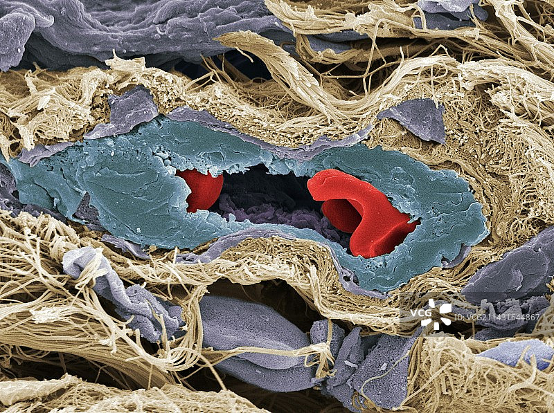 肿瘤扫描电镜图图片素材