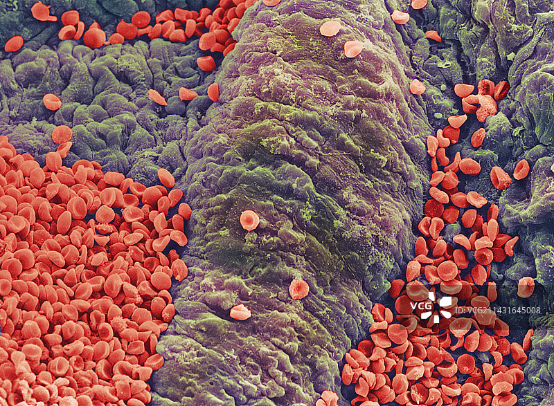 血管壁上红细胞的彩色扫描电镜图图片素材