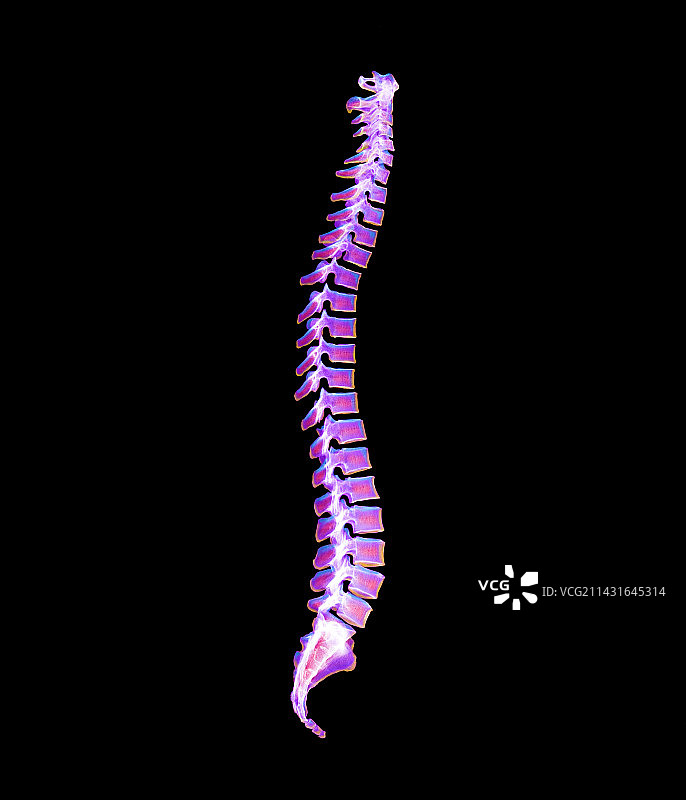 健康的脊柱彩色X光片图片素材
