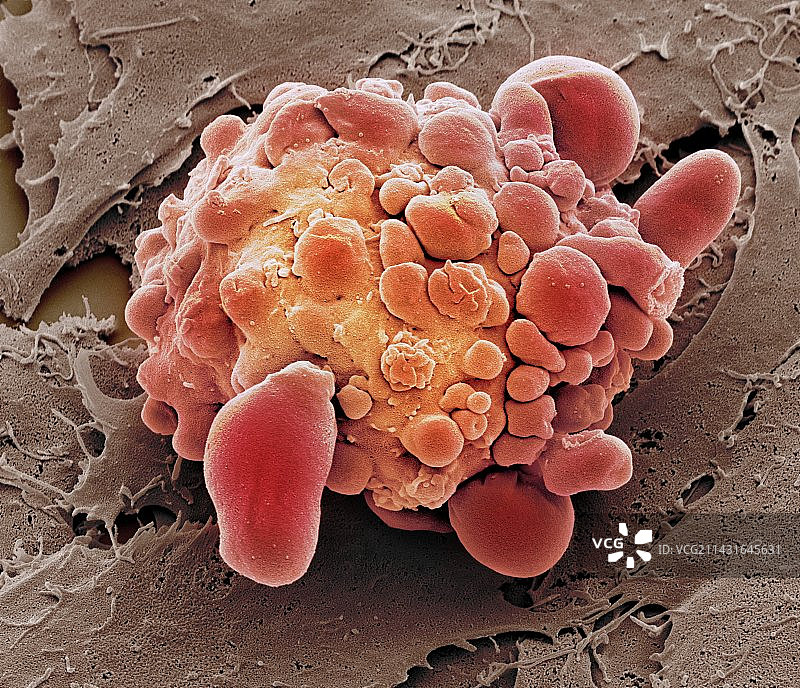 垂死的干细胞，扫描电子显微镜图片素材