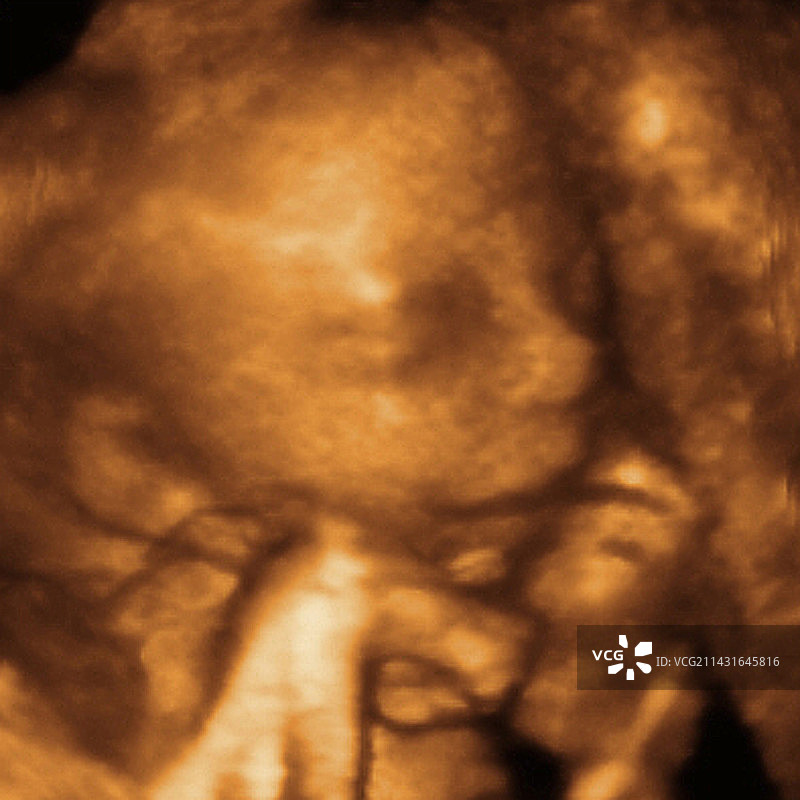 胎儿面部3D超声波扫描图片素材