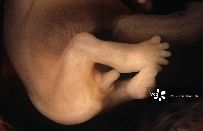 10周大的胎儿生殖器图片素材