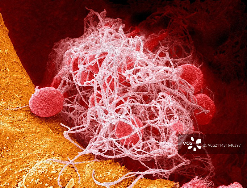 血栓扫描电镜图片素材