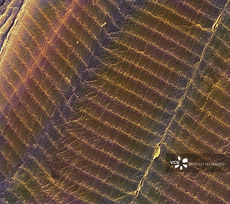 骨骼肌，扫描电镜图图片素材