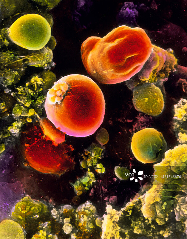 原始生殖细胞的彩色扫描电镜图图片素材