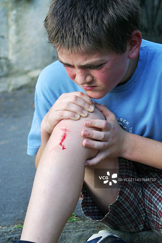 膝盖割伤图片素材