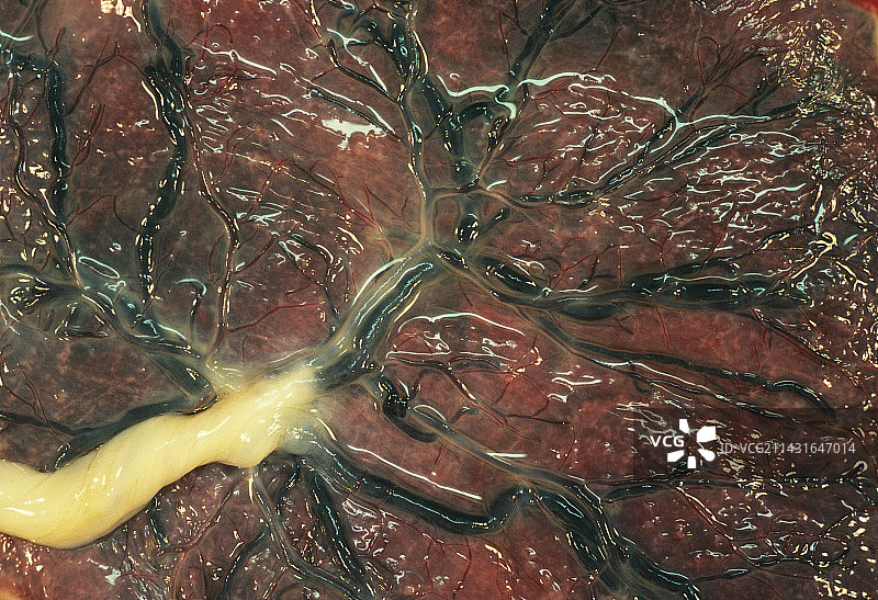 人类胎盘图片素材