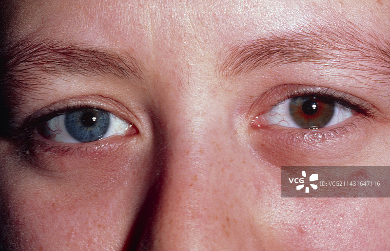 拥有不同瞳孔颜色的人图片素材