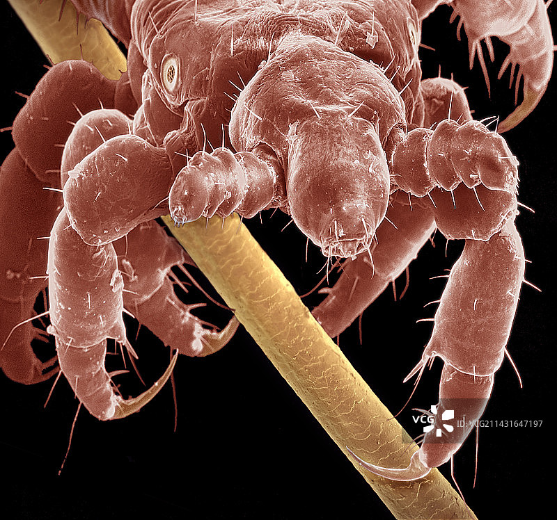 头虱，扫描电子显微镜图片素材