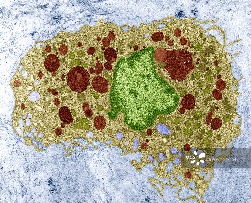 巨噬细胞透射电镜图图片素材