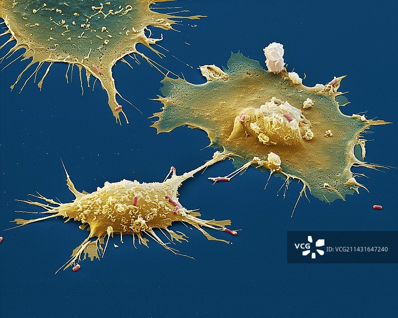 巨噬细胞攻击细菌，扫描电子显微镜图片素材