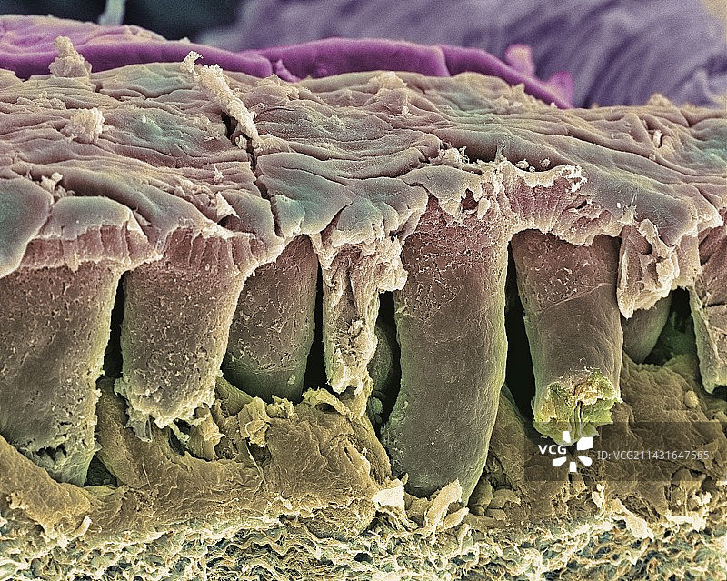 大肠内壁扫描电镜图图片素材