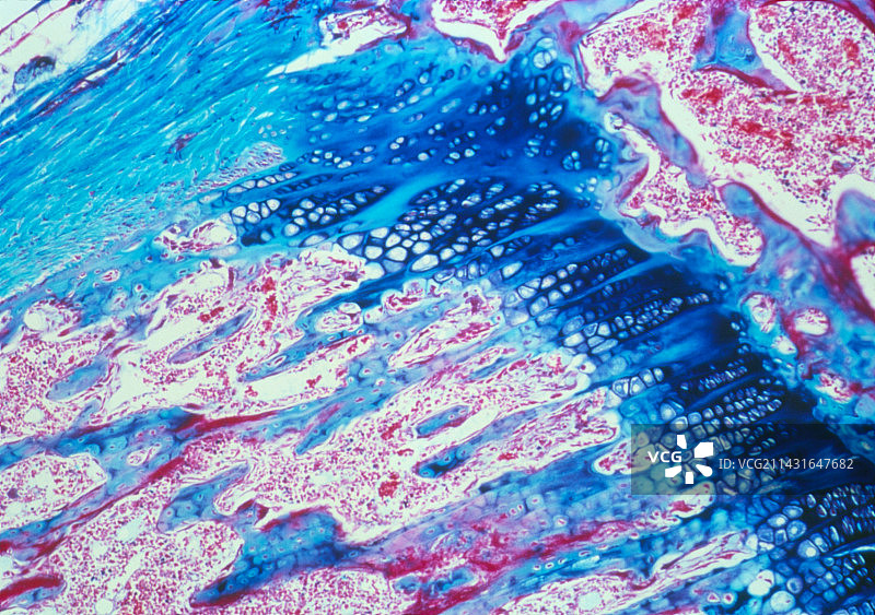 骨骼形成图片素材