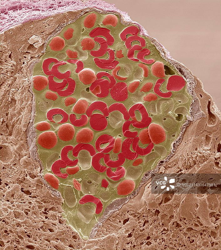 视网膜血管，扫描电子显微镜图图片素材
