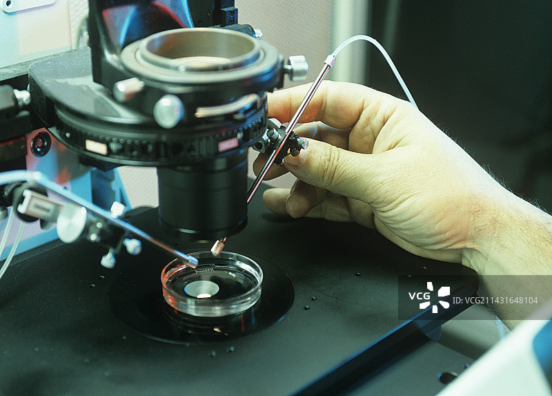 试管婴儿治疗图片素材