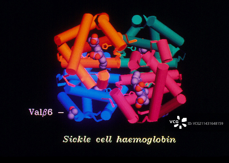镰状细胞血红蛋白的计算机图形图片素材