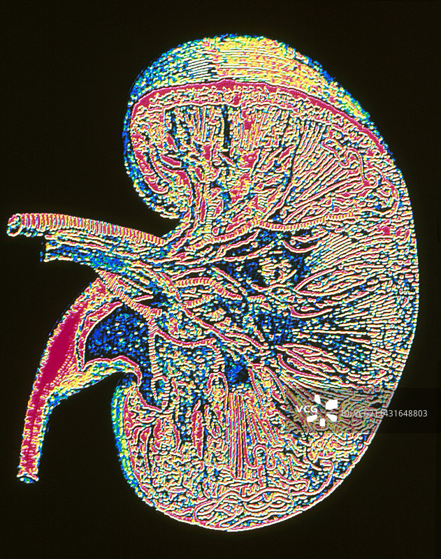 人体肾脏截面电脑图形图片素材