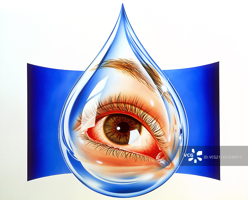 红眼病眼睛的泪滴艺术作品图片素材