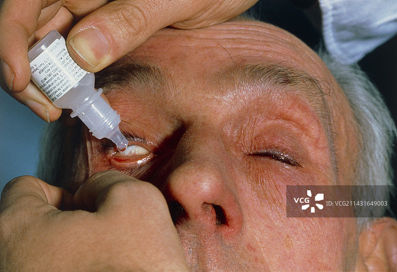 给眼睛滴散瞳眼药水图片素材