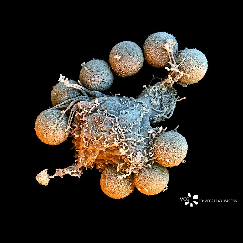T淋巴细胞和铁颗粒，扫描电镜图片素材