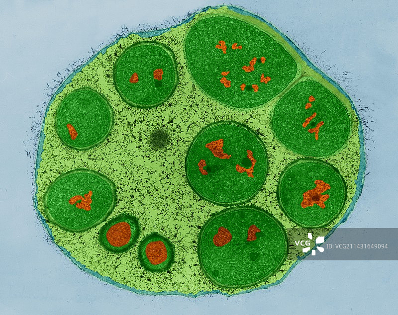 蓝细菌内生孢子（Dermocarpa sp.）TEM图片素材