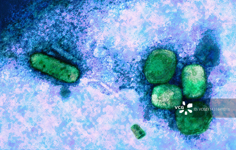 天花病毒颗粒，TEM图片素材