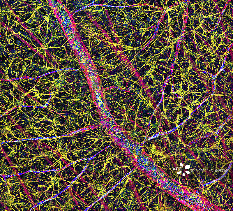 视网膜血管和神经细胞图片素材