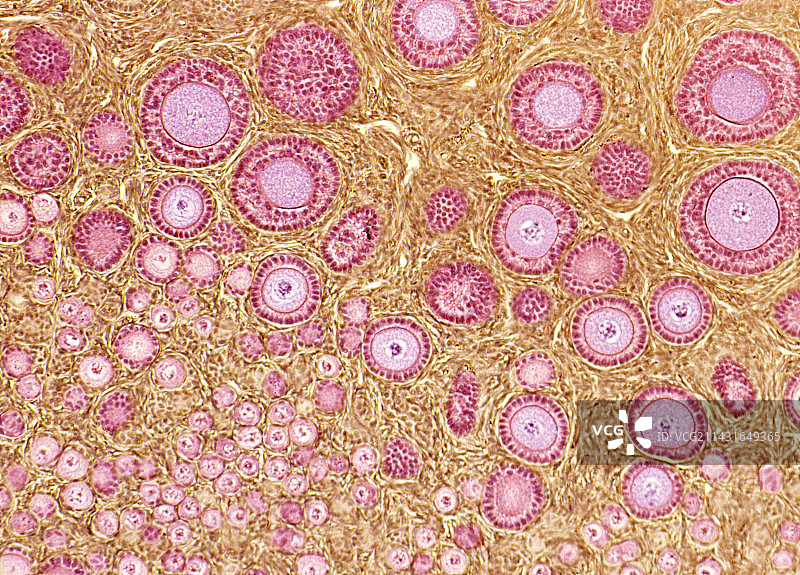 卵巢卵泡显微照片图片素材