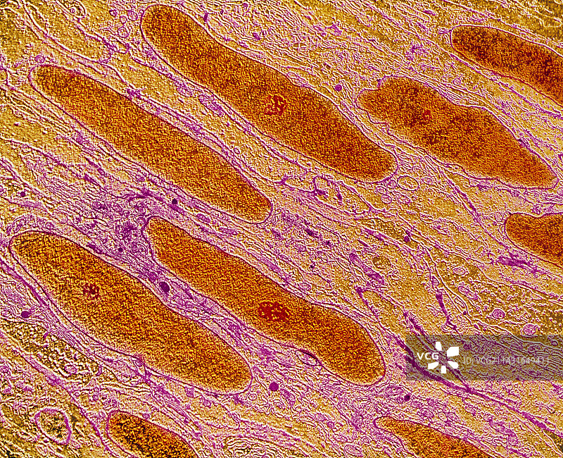 子宫壁平滑肌的彩色透射电镜图片素材