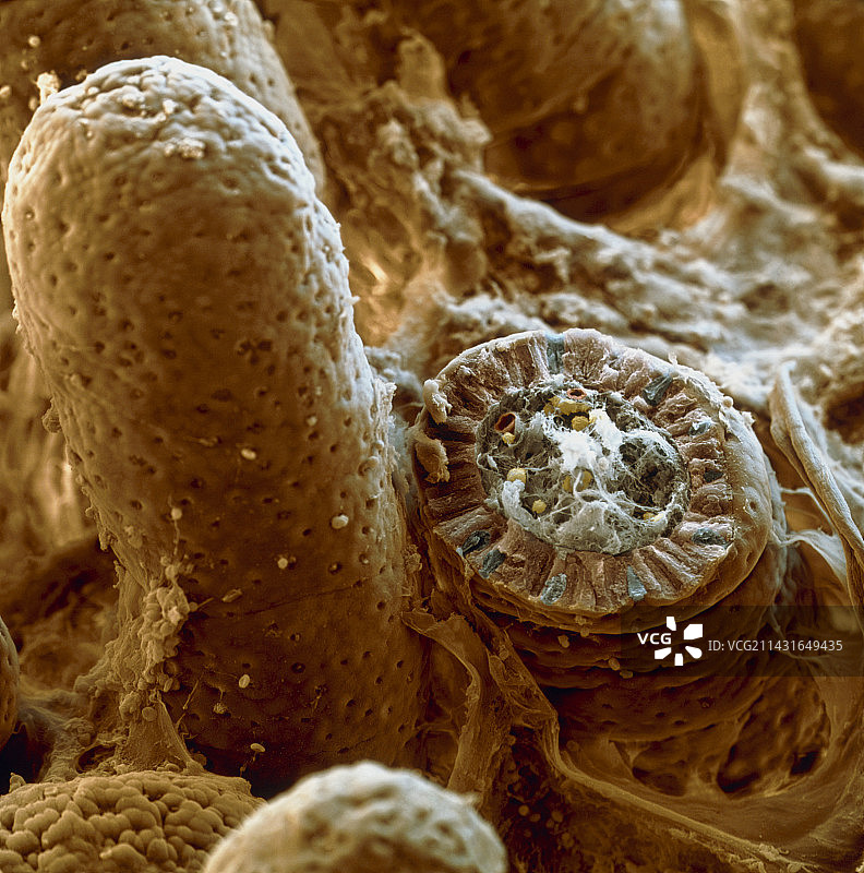 小肠绒毛，扫描电镜图片素材