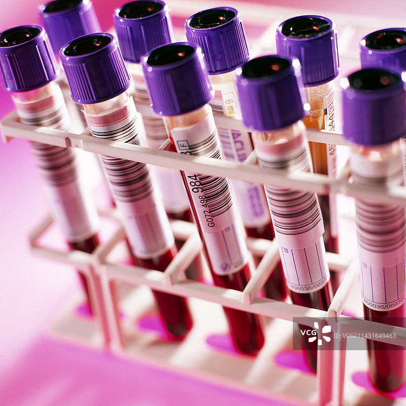 用于分析的血液样本试管架图片素材
