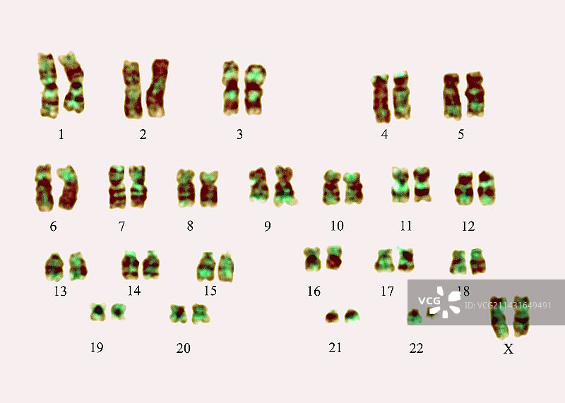 费城染色体图片素材