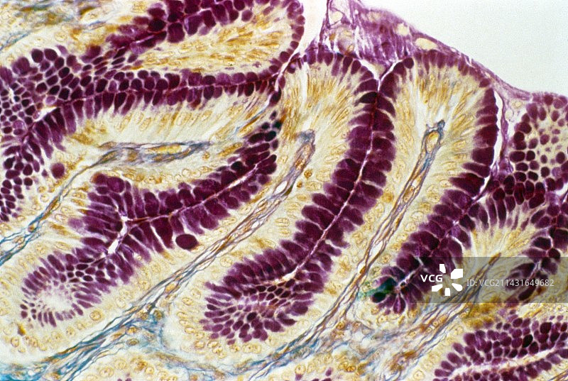 胃壁衬里显微照片图片素材
