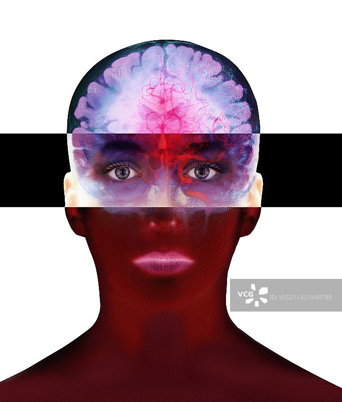 大脑扫描图片素材