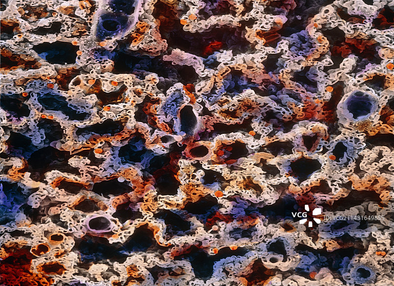 肺部组织切片的伪彩色扫描电镜图像图片素材