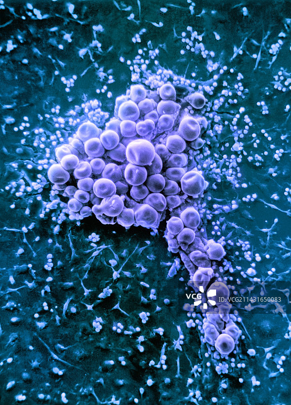 脂肪细胞，扫描电镜图片素材