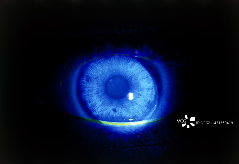 紫外线下荧光素突显的正常眼睛图片素材