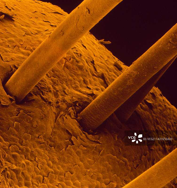 人体皮肤表面的扫描电镜图图片素材