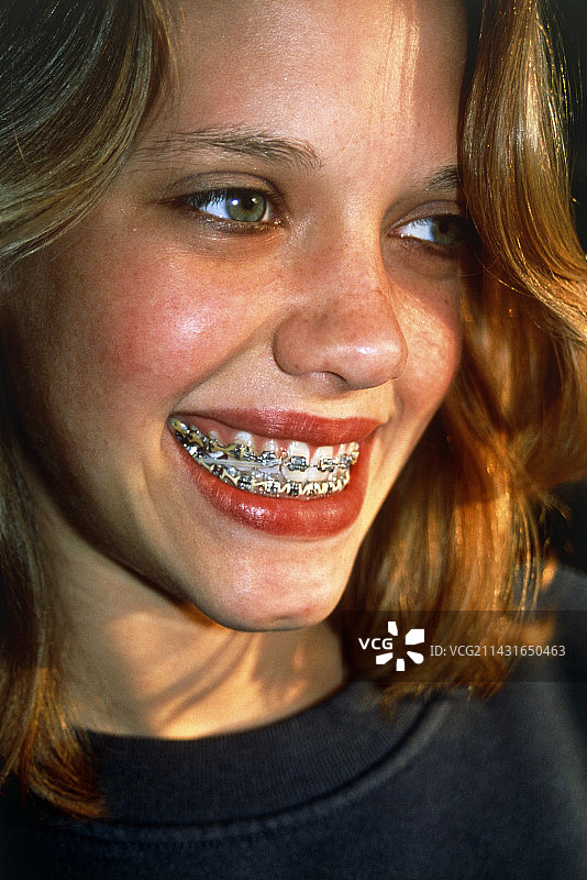 戴牙套的女孩图片素材