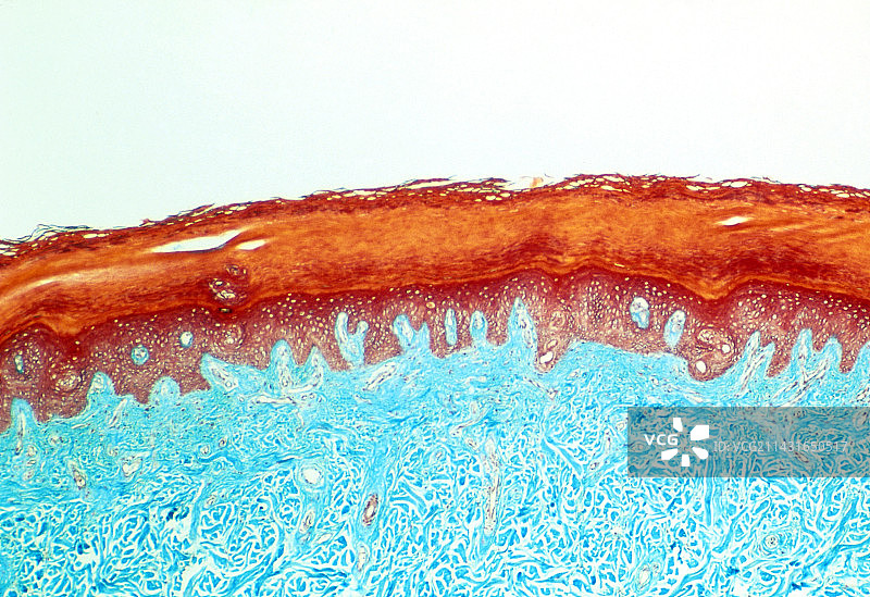 人体皮肤切片的显微照片图片素材