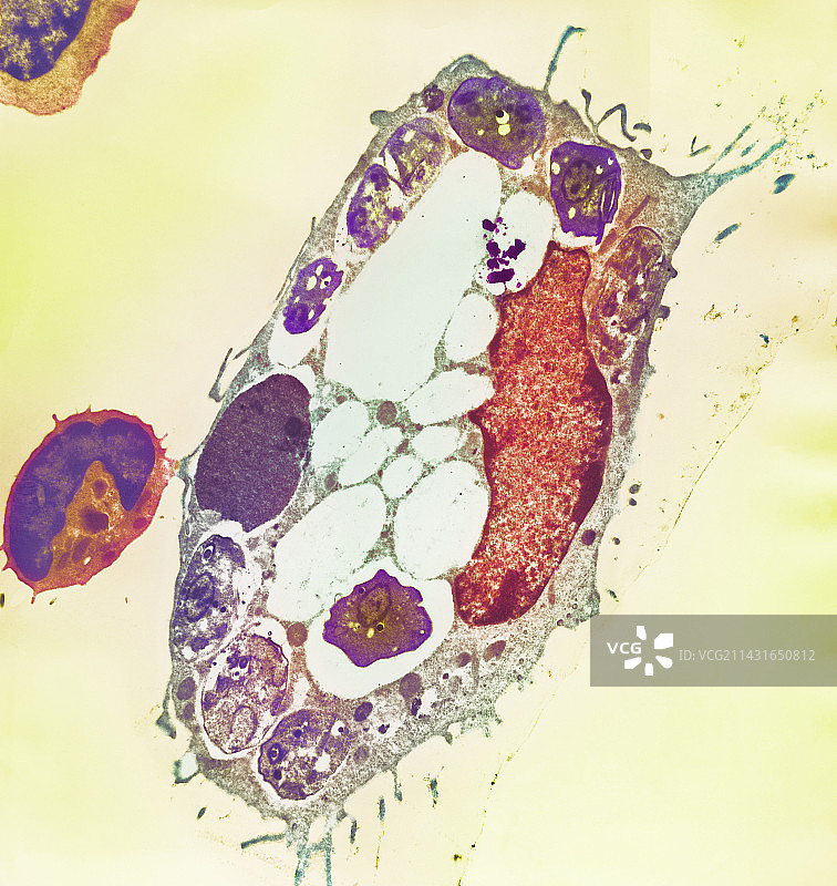 利什曼原虫,透射电镜图片素材