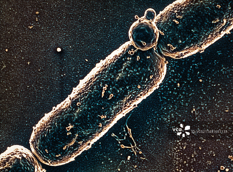 炭疽杆菌，扫描电镜图片素材